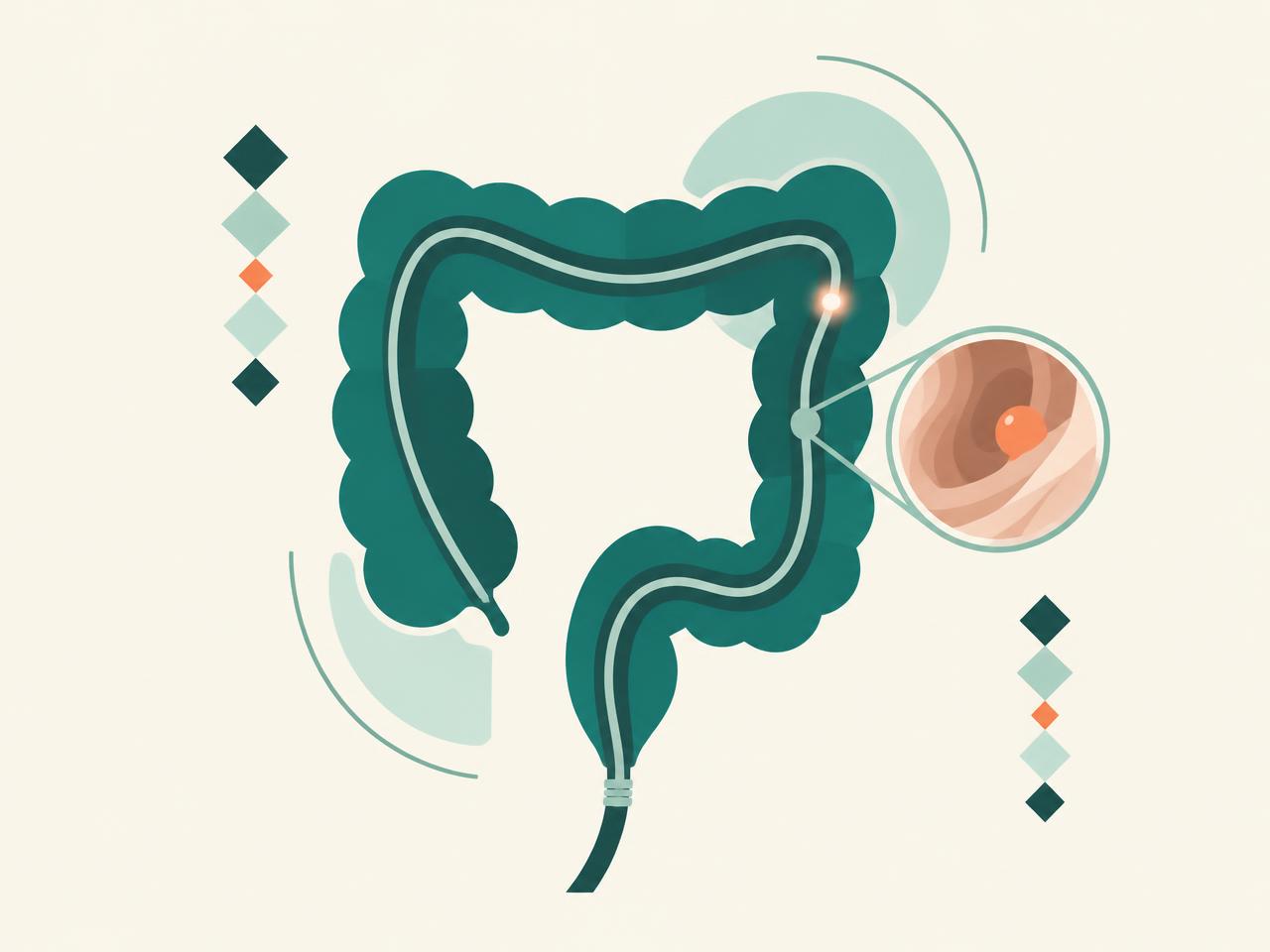 Ilustração do intestino grosso representando o exame de colonoscopia